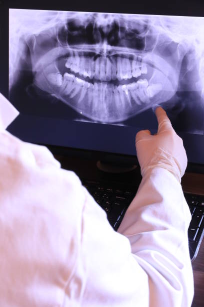 Best Emergency TMJ Treatment in California, PA
