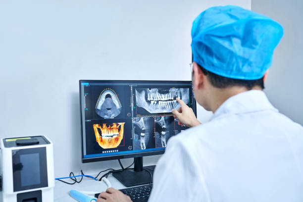 Best Emergency Treatment for Dental Infections or Abscesses in California, PA